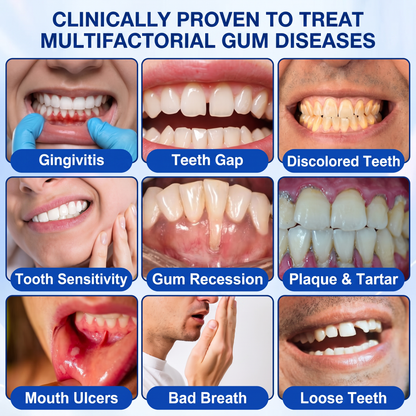 🇬🇧Pureluxo® 🦷  periodontal repair gel 🧑‍⚕️