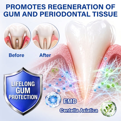 🇬🇧Pureluxo® 🦷  periodontal repair gel 🧑‍⚕️