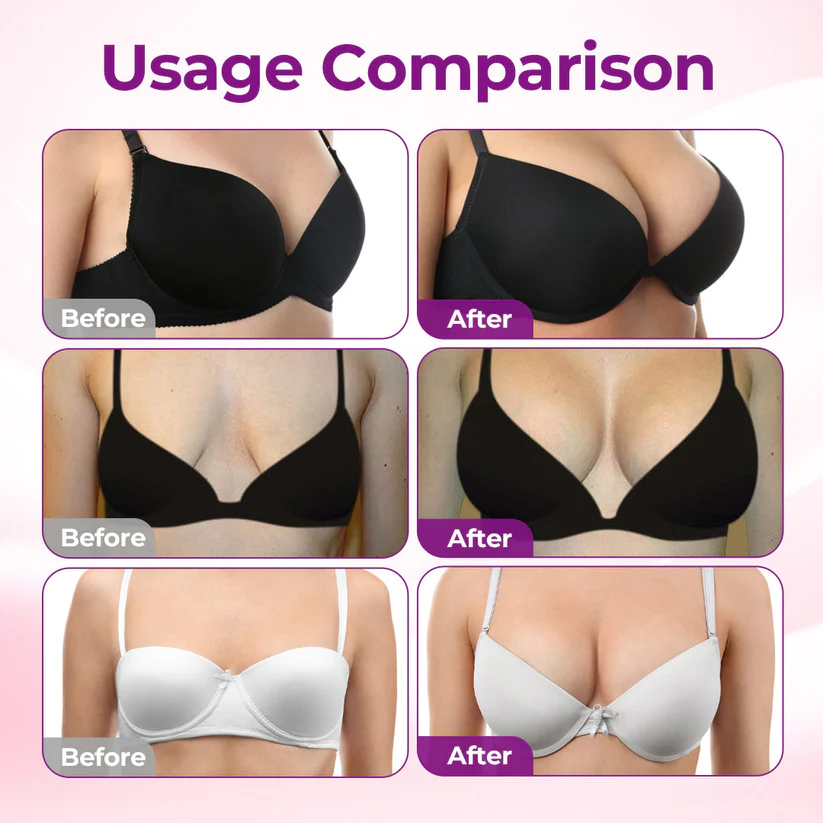 Turonu® Breast Care Nano-Microneedle Patch