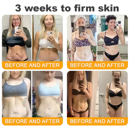 Made and Shipped from UK ✨ Pureluxo® Bee Venom Skin Restoration Cream ⏰ LAST DAY 80% OFF🛒