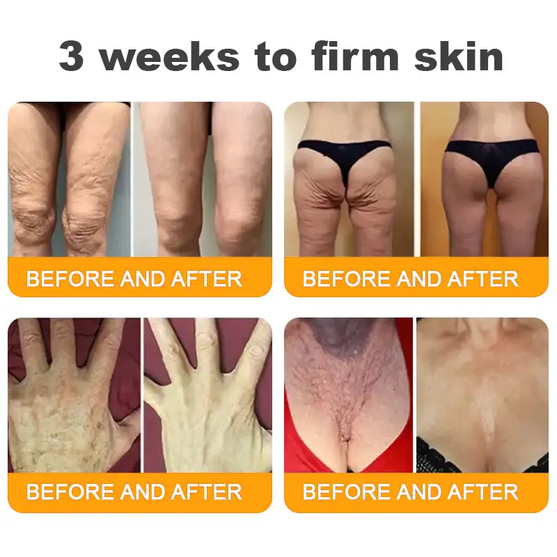 Made and Shipped from UK ✨ Pureluxo® Bee Venom Skin Restoration Cream ⏰ LAST DAY 80% OFF🛒