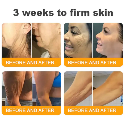 Made and Shipped from UK ✨ Pureluxo® Bee Venom Skin Restoration Cream ⏰ LAST DAY 80% OFF🛒