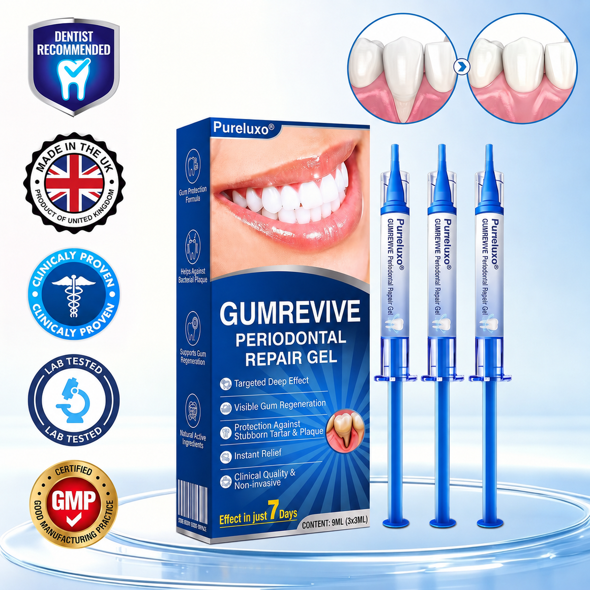 🇬🇧Pureluxo® 🦷  periodontal repair gel 🧑‍⚕️