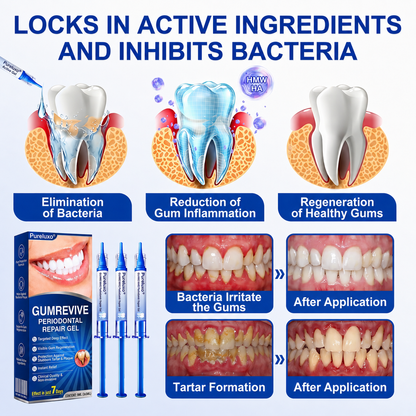 🇬🇧Pureluxo® 🦷  periodontal repair gel 🧑‍⚕️