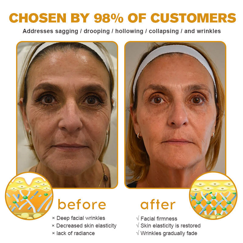 Made and dispatched in the UK✨ Pureluxo® Botox Bee Venom Wrinkle Removal Cream👨‍⚕️Recommended by dermatology experts🥑LAST DAY 80% OFF